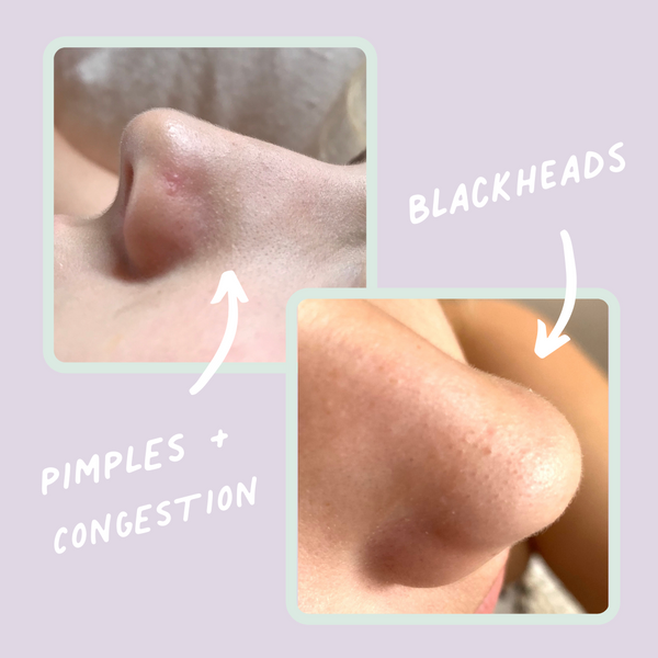 PETITE SKIN CO - MY FIRST SKIN CARE ROUTINE (CONFETTI COLLECTION)