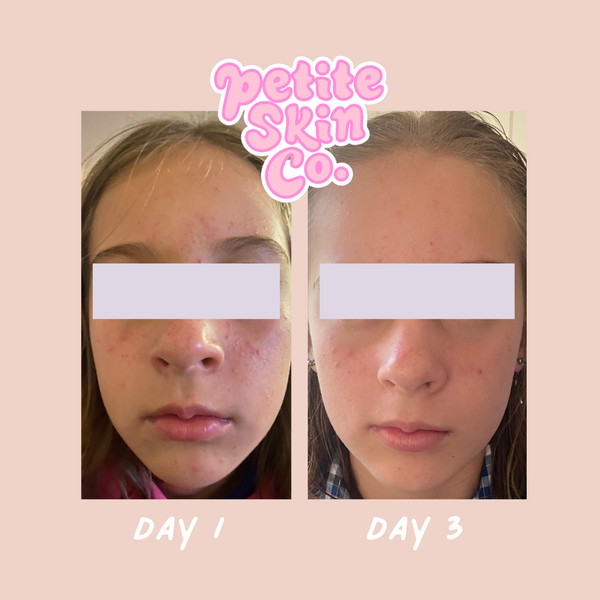 PETITE SKIN CO - MY FIRST SKIN CARE ROUTINE (CONFETTI COLLECTION)